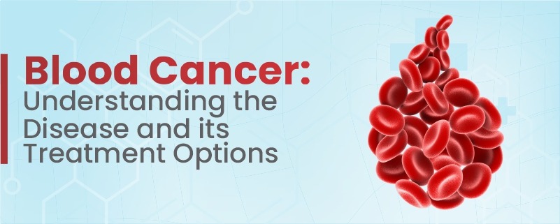 Blood Cancer: Understanding the Disease, Recognizing Symptoms, and Exploring Treatment Options
