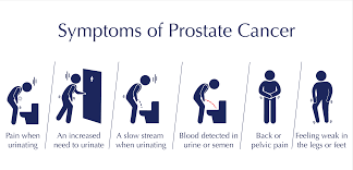 Common Symptoms of Prostate Cancer