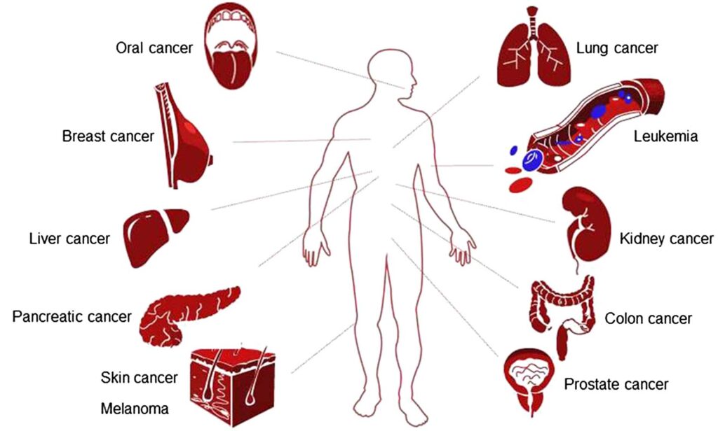 Which Is the Hardest Cancer to Cure? Unraveling the Complexities of Cancer Treatment