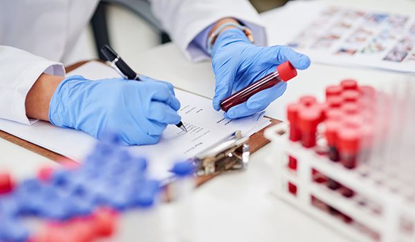 Doctor explaining liquid biopsy blood test for early cancer detection and monitoring